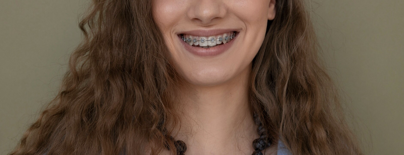 Can Adults Get Braces? Embrace a New Smile at Any Age!